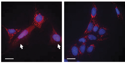 Normal mouse cells (l) and cells in which the MTCH2 gene is knocked out (r), after exposure to a cell suicide factor. Arrows point to a protein that initiates the cell suicide program, which is only released from mitochondria with functioning MTCH2